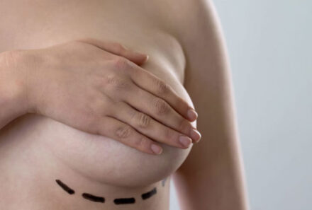Protesi e tumore al seno: consigli e controlli periodici