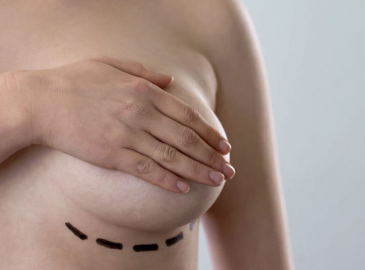 Protesi e tumore al seno: consigli e controlli periodici